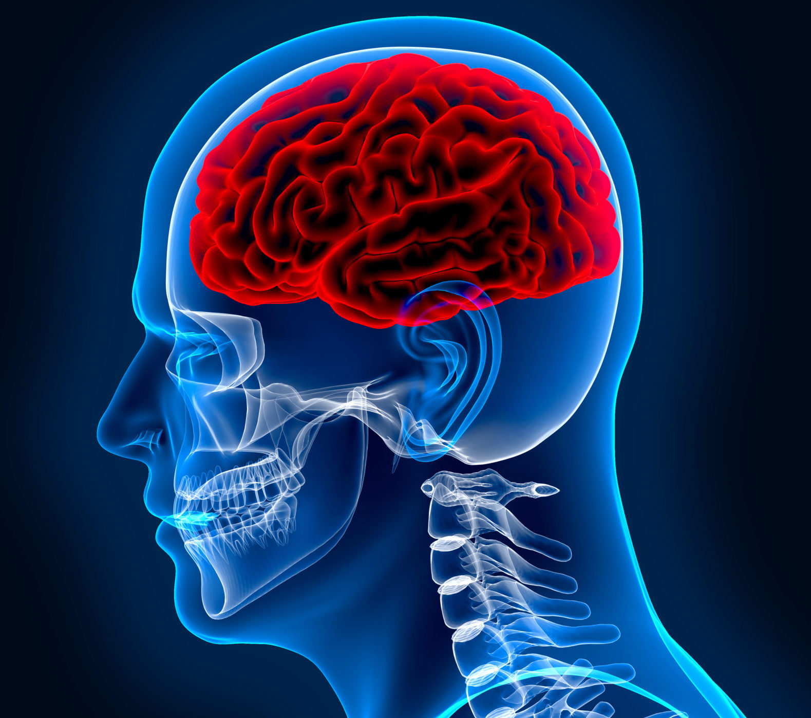 Traumatic Brain Injury